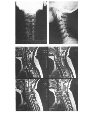 diagnostics of cervical osteochondrosis