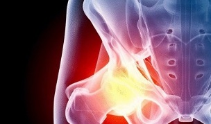 causes of the development of osteoarthritis of the hip