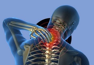 causes of cervical osteochondrosis