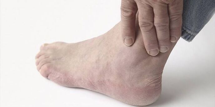 pain in arthrosis of the ankle