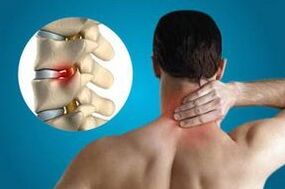 Pinching of the vertebrae