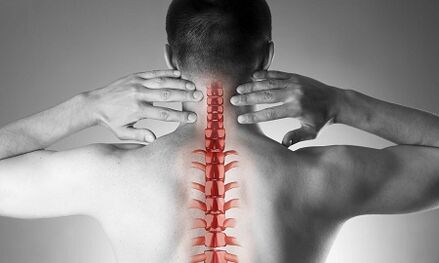 How osteochondrosis of the cervical spine manifests itself